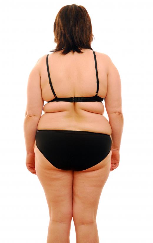 There is no scientific evidence that indicates drinking diet soda causes obesity.