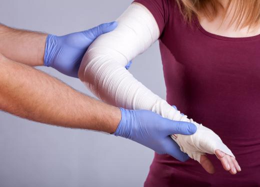 Special dressings may be necessary to promote healing and prevent infection on severe chemical burns from sulfuric acid.