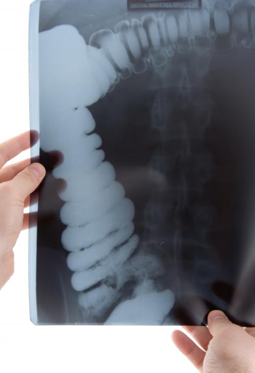 Barium is used in hospital settings to give doctors a clear view of a patient's digestive tract.
