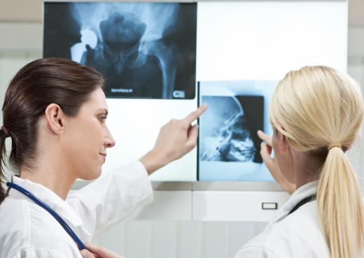 Neutron beams may be used as an alternative imaging technique when X-rays are not effective.