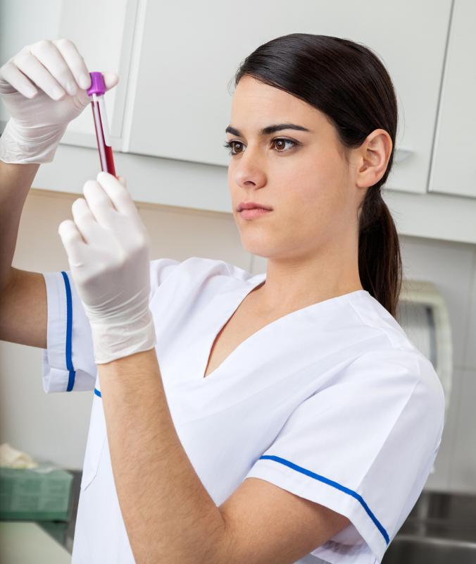 What are the Different Types of Human Antigen? (with pictures)