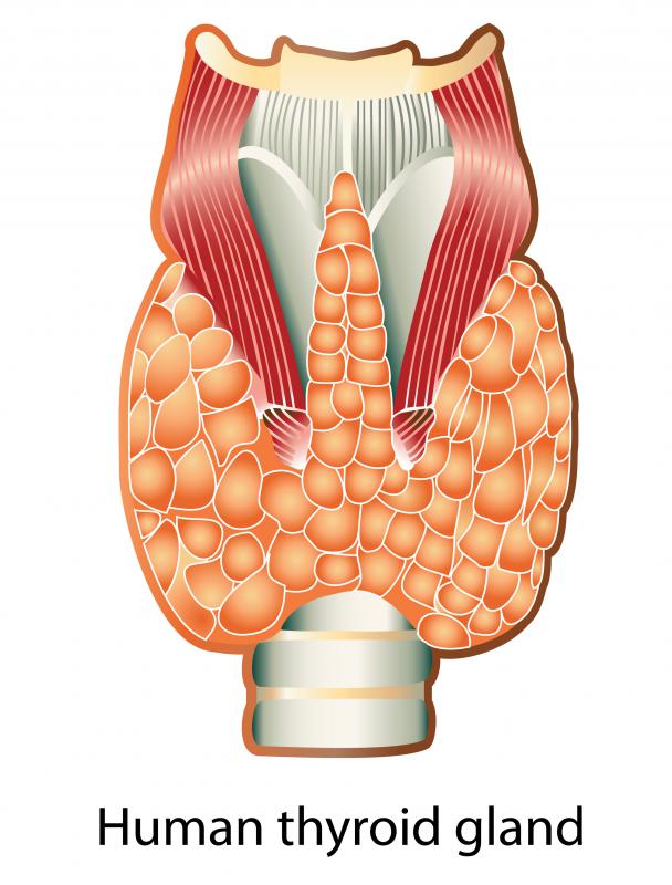 What is Iodine? (with pictures)