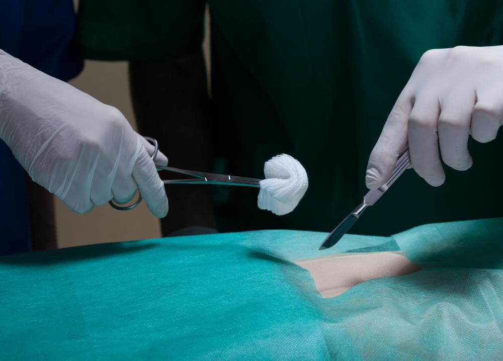 What Is Carbolic Acid? (with pictures)