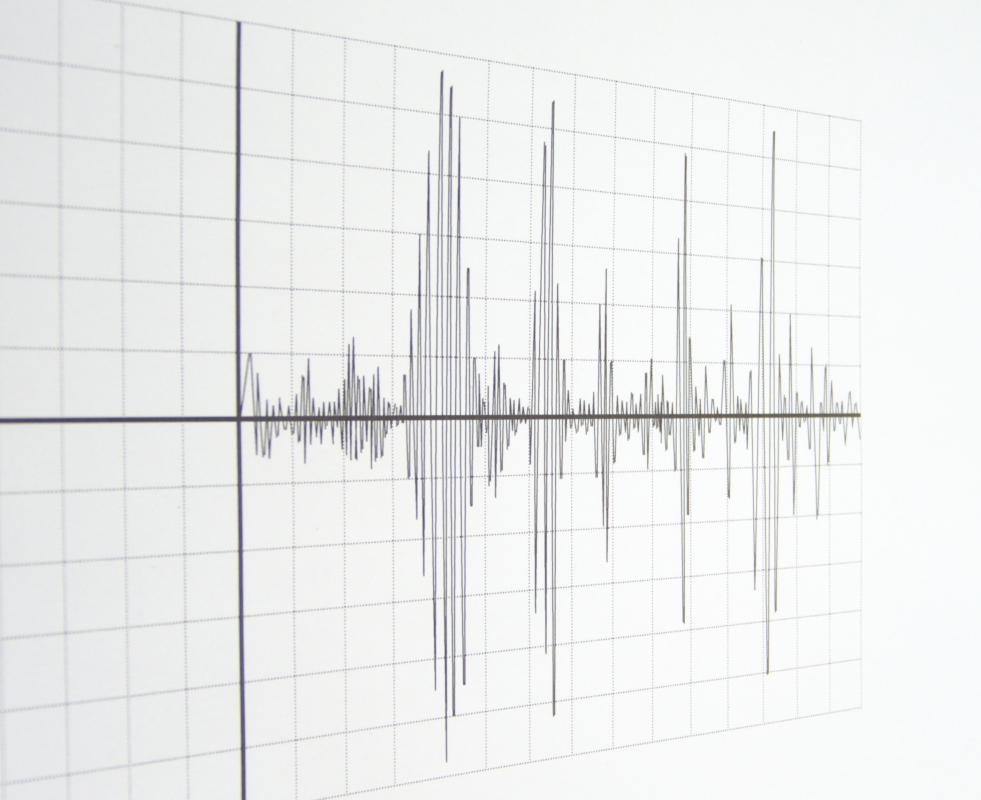 What Is Seismic Data Acquisition with Pictures 