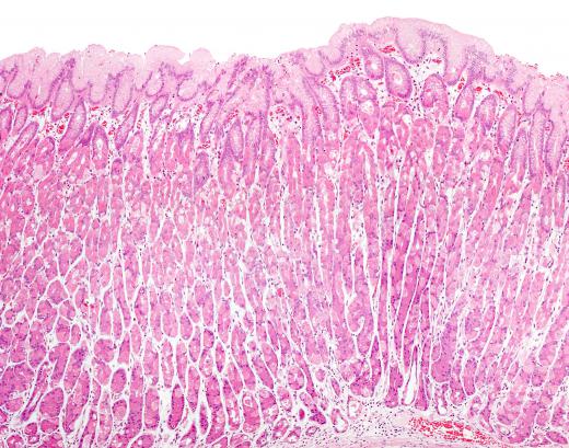 H2 histamine receptors can be found in the parietal cells of the stomach.